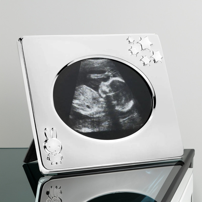 Ramka na zdjęcie USG 